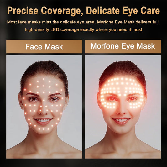 Morfone Red Light Therapy for Eyes & Forehead, 4 Modes Under-Eye Infrared Red Light Eye Mask, Portable Eye Massager for Men Women (Black)