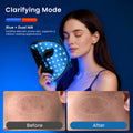 Morfone Red Light Therapy Mask for Face, 4 Modes LED Face Mask, 850NM Infrared & Red Light Mask, 400 LEDs, Eye Protection & Timing Function at Home, Travel