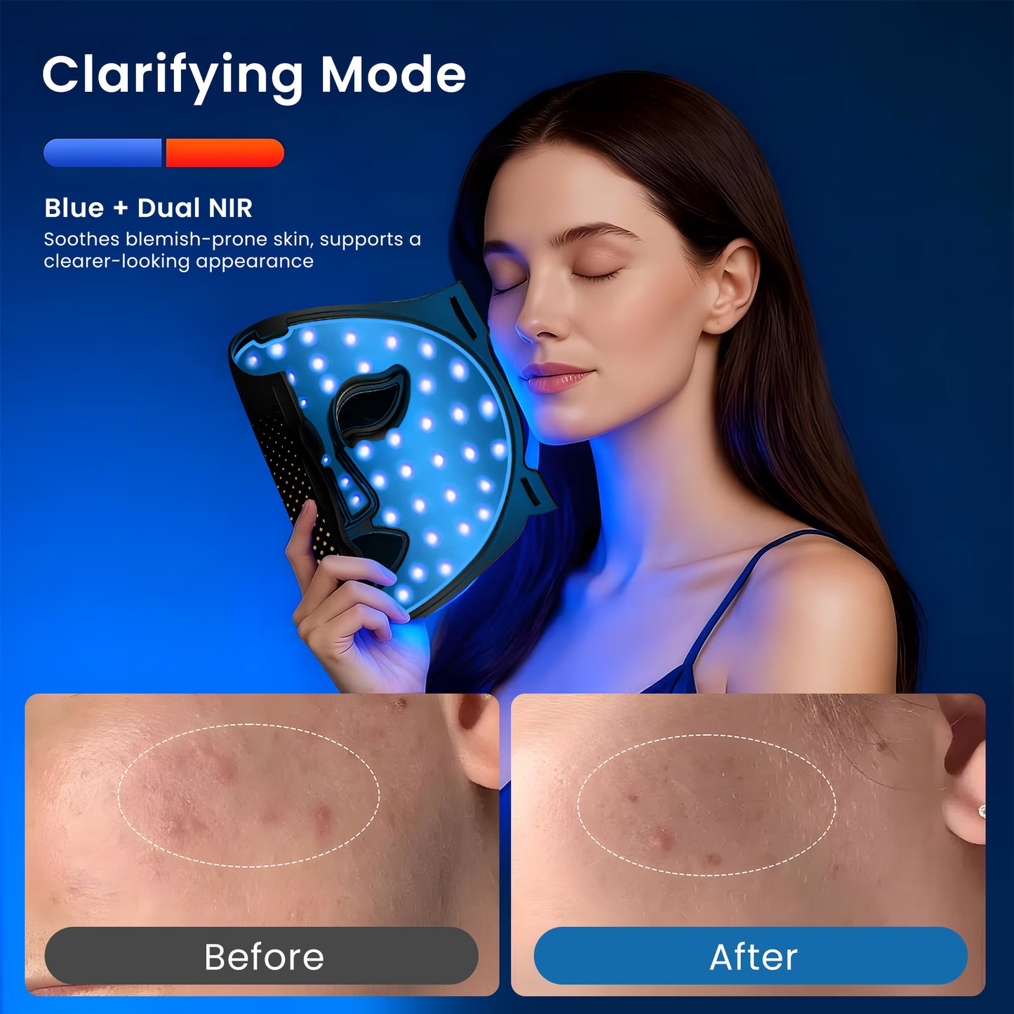 Morfone Red Light Therapy Mask for Face, 4 Modes LED Face Mask, 850NM Infrared & Red Light Mask, 400 LEDs, Eye Protection & Timing Function at Home, Travel